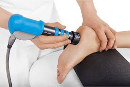 Extra corporal Shockwave therapy