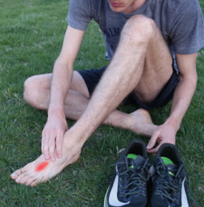 man with foot stress fracture